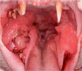 Stomatitis